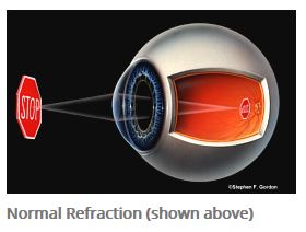 eye refraction diagram