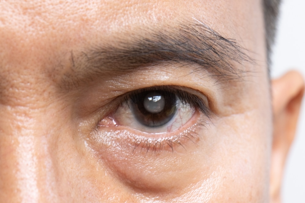 https://www.crewslasercenter.com/early-symptoms-of-cataracts-you-shouldnt-ignore/